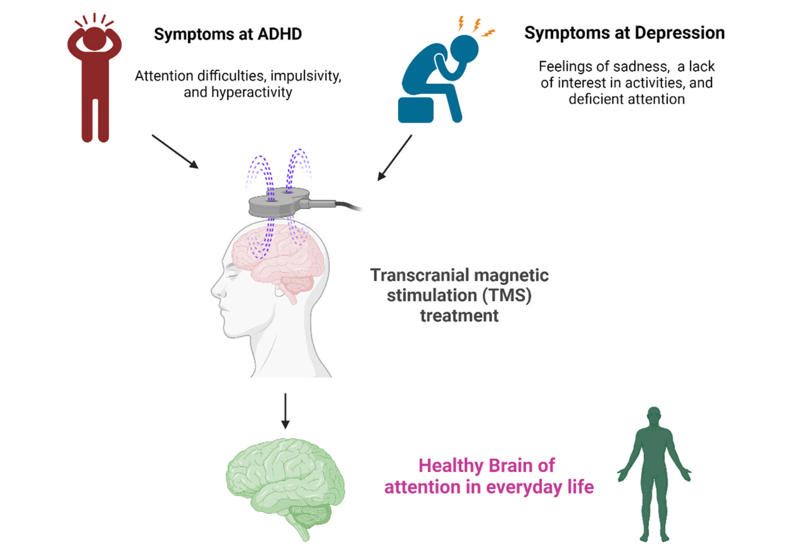 TMS Advancements in Treating Mental Health Challenges
