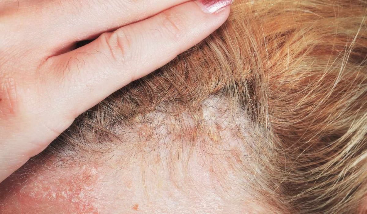 Healing the Scalp: Hair Growth Treatments for Damaged Skin