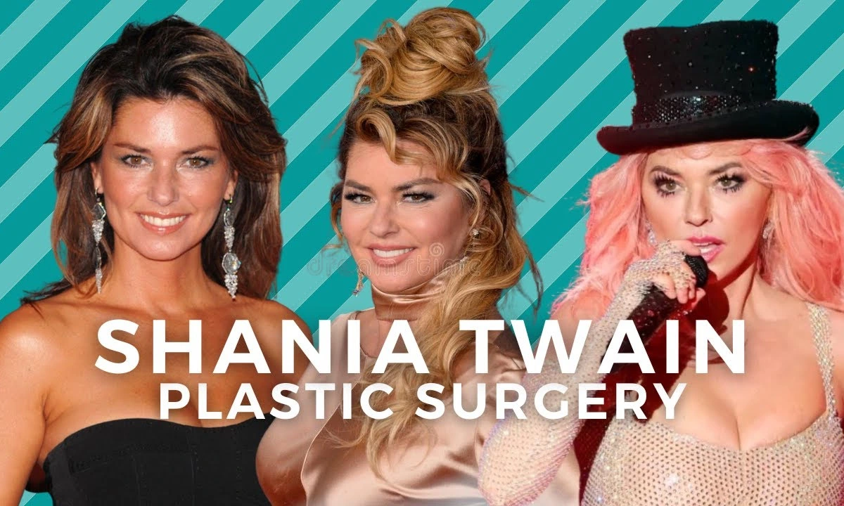 Shania Twain Plastic Surgery: A Closer Look