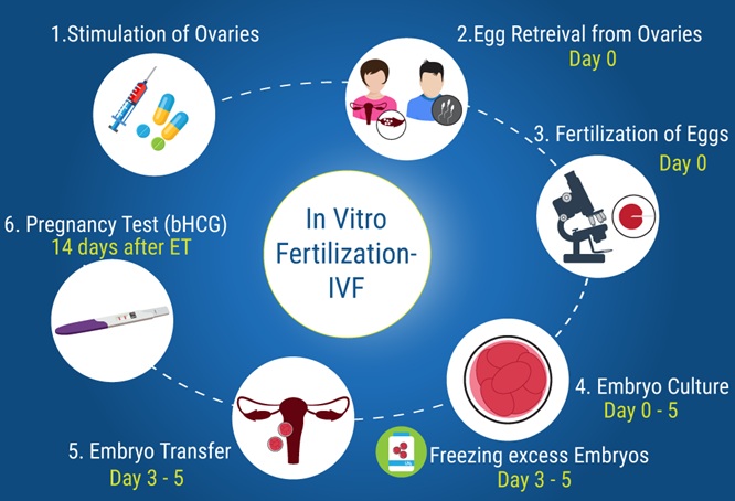 The IVF Process: Everything You Should Know Before Starting Treatment