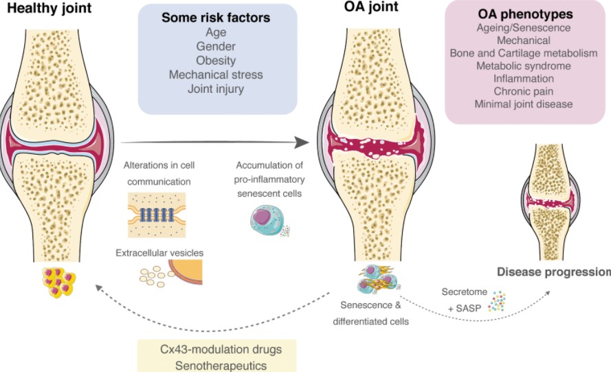 The Science Behind Arthrogenix: A Revolutionary Solution for Joint Health