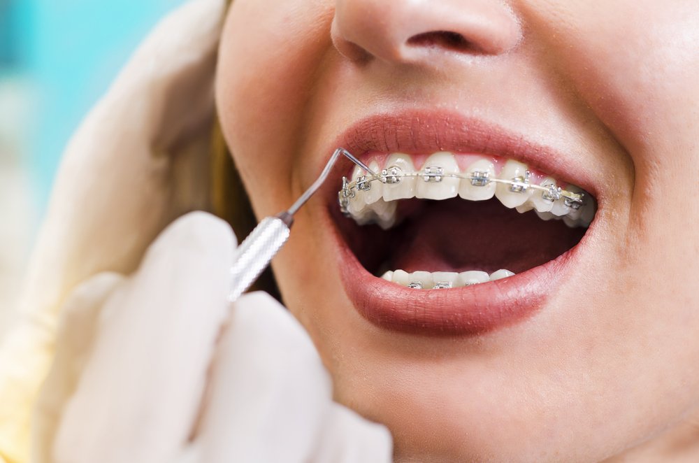 Staying on track with orthodontic care amid seasonal illness and testing precautions