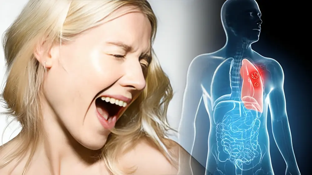 Is Burping a Lot a Sign of Cancer? Know the Truth & Causes