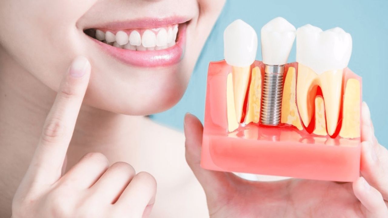 Nuvia Dental Implant Center vs. Glenwood Premier Dental Group