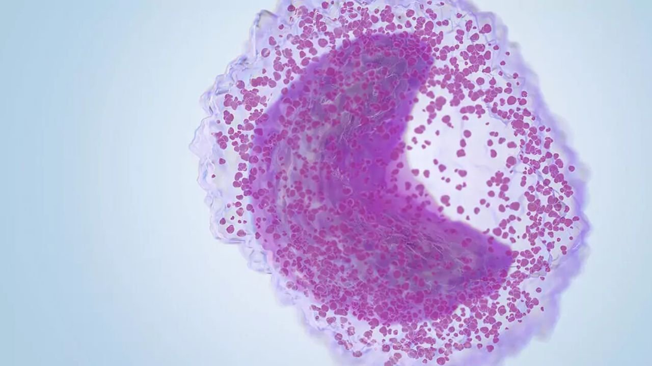 Immature Granulocytes High: Causes, Tests & Next Steps