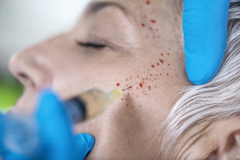 Harnessing the Power of Light: A New Era in Skin Rejuvenation
