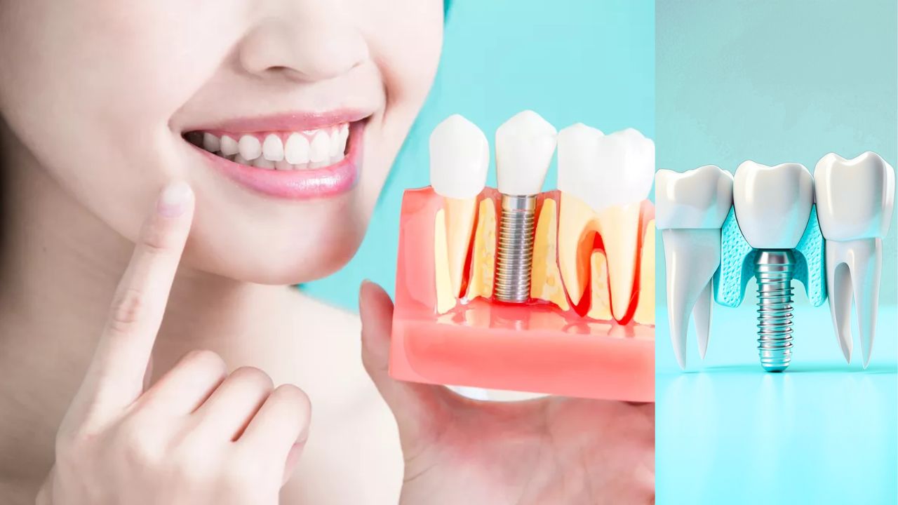 Dental Implants Abroad Helvetic Clinics | Affordable Care