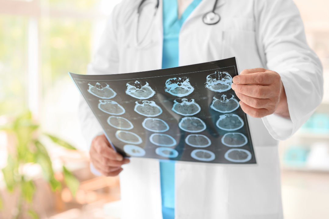 9 Steps to Consider When Choosing the Best Neurologist in Udaipur