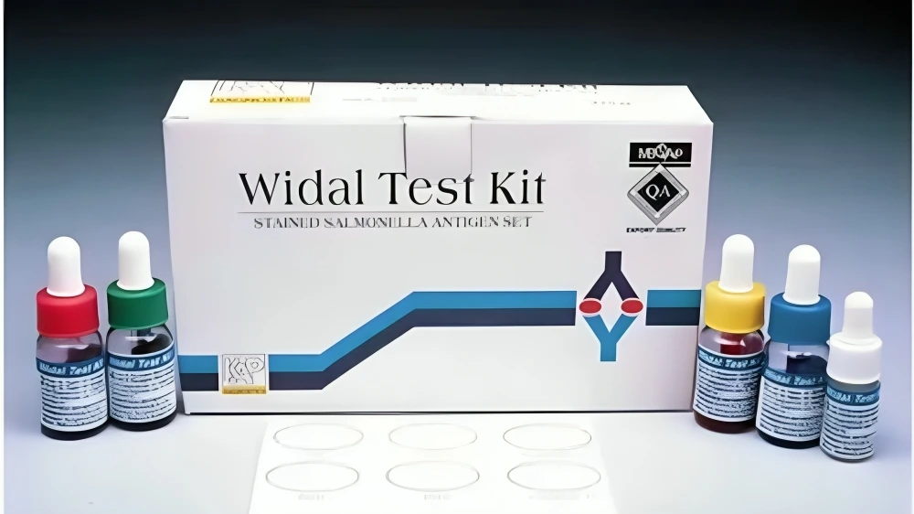 widal test 180 means
