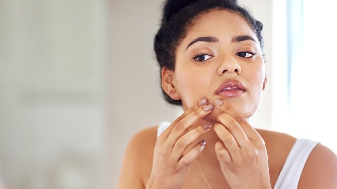 How Singapore’s Humid Weather Affects Acne-Prone Skin